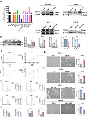 SPAG6 overexpression decreases the pro-apoptotic effect of daunorubicin in acute myeloid leukemia cells through the ROS/JNK MAPK axis in a GSTP1-dependent manner